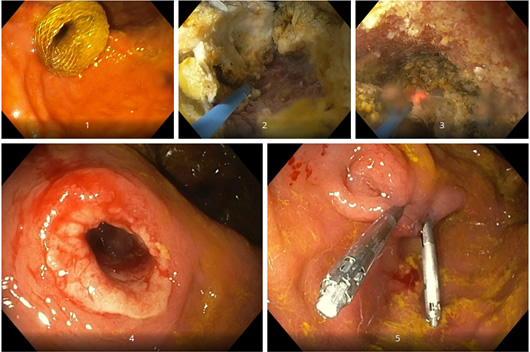 Clinical Case