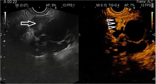 Clinical Case
